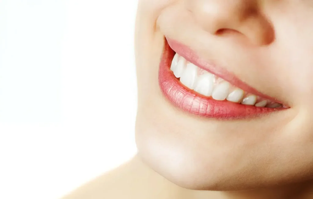 Professional Teeth Whitening 