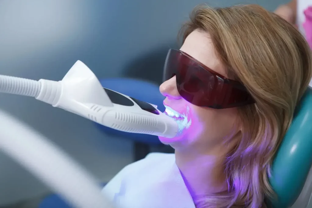 Professional Teeth Whitening Service 