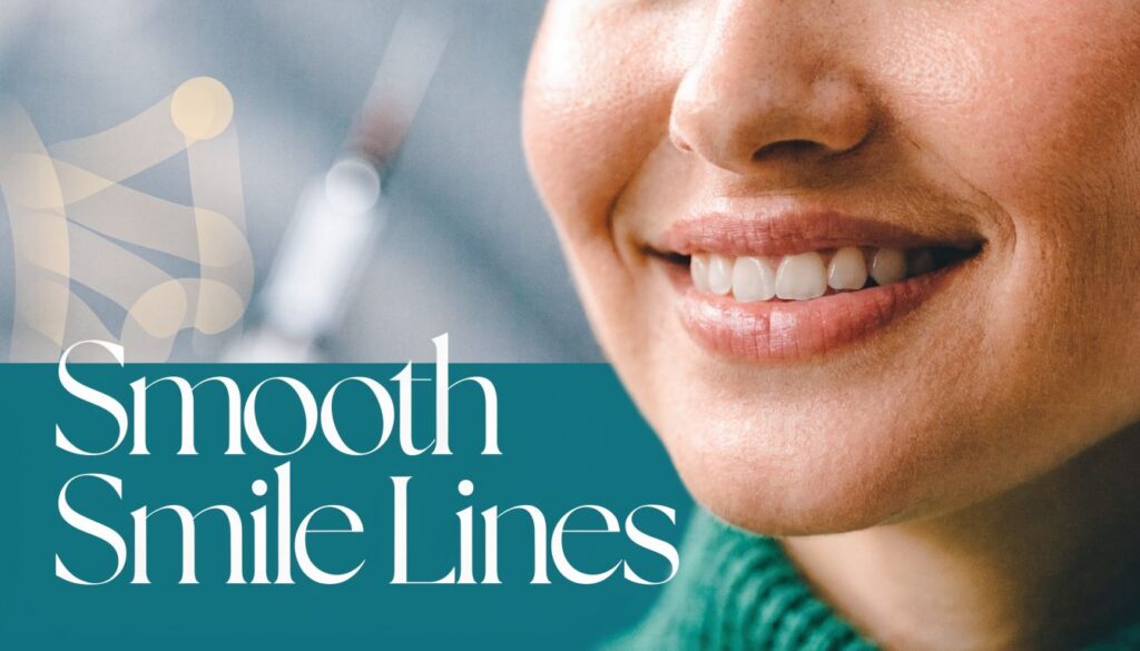 botox-for-smile-lines-smile-lines