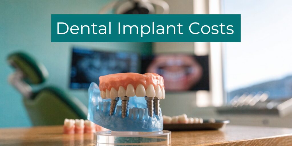 Full Mouth Dental Implants Cost