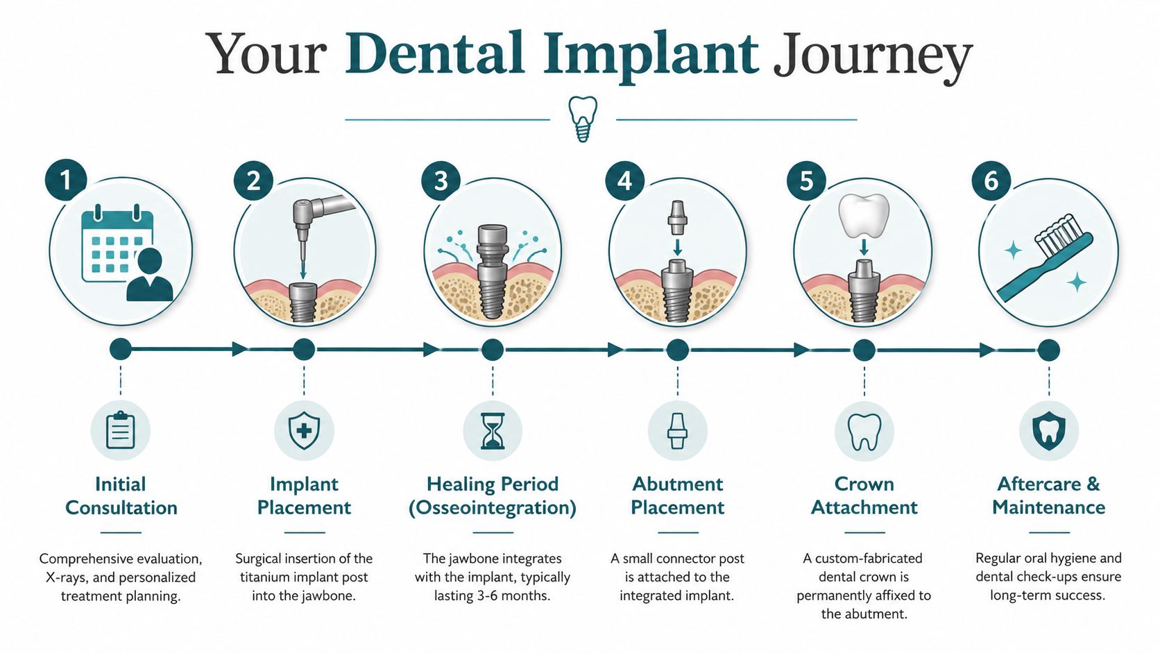 An infographic detailing the six stages of the dental implant procedure from consultation to long-term aftercare.