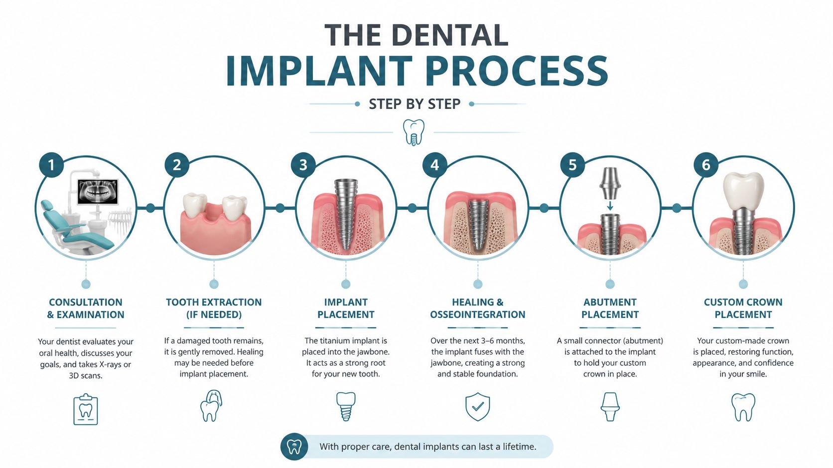 An infographic detailing the six steps of the dental implant process from consultation to custom crown placement.