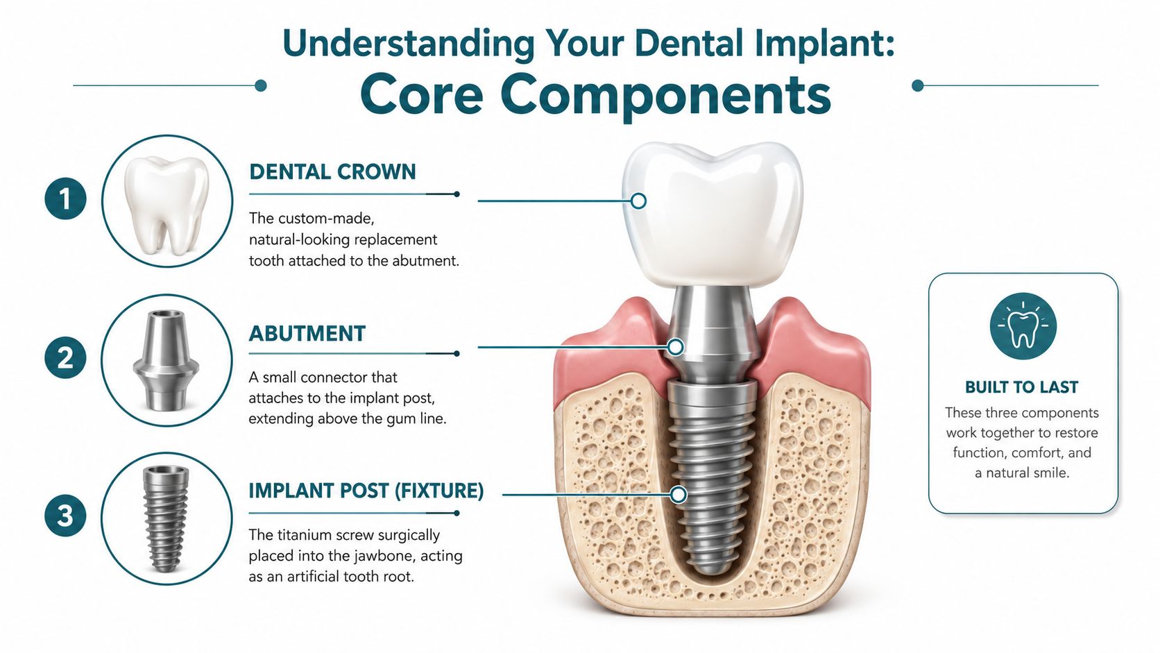 An educational infographic illustrating the three main components of a dental implant, including the crown, abutment, and post.