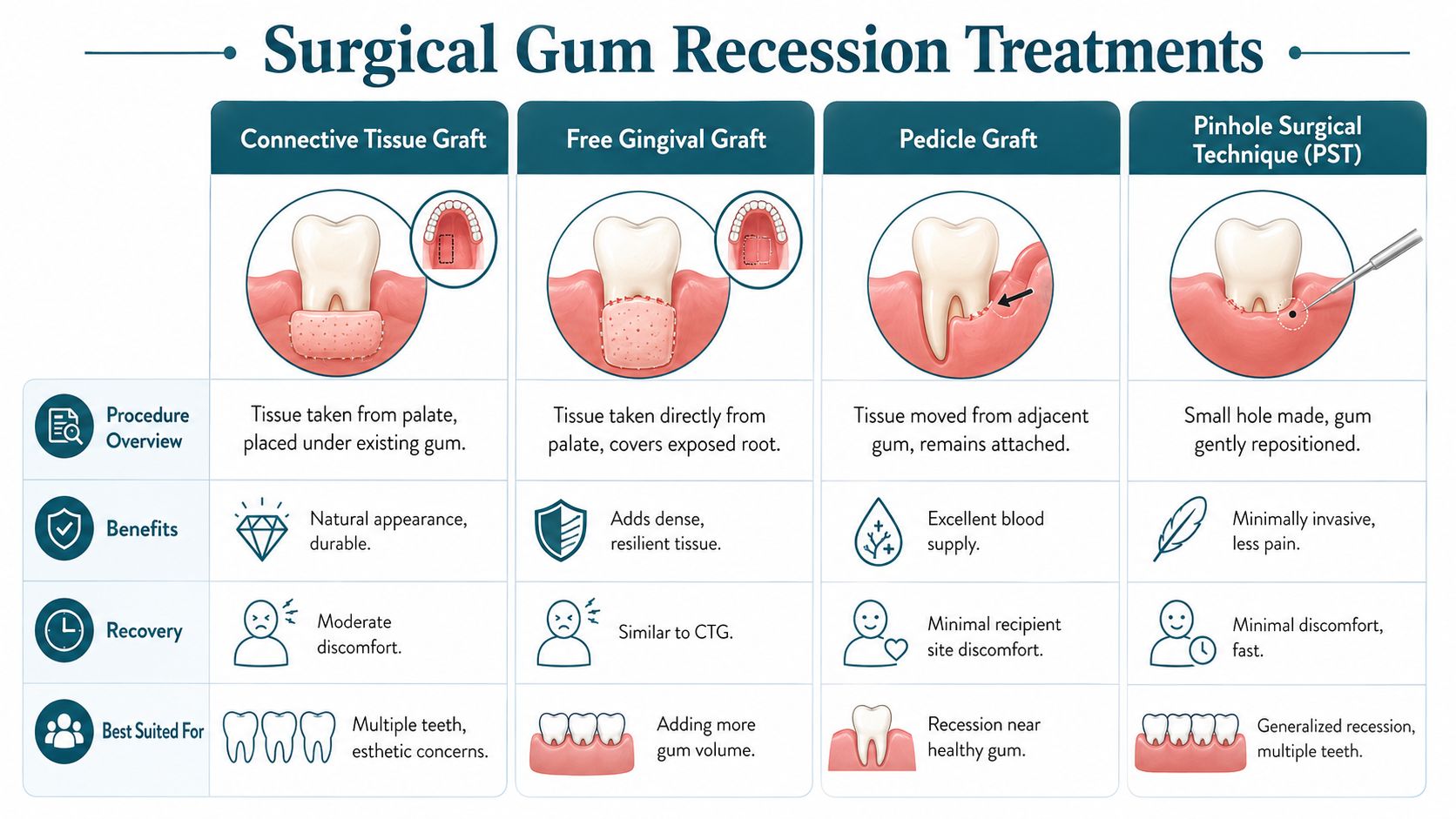 A detailed medical infographic comparing four types of surgical gum recession treatments including grafts and pinhole surgery.