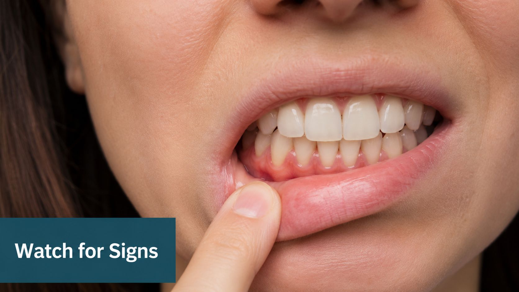 A close-up view of a person pulling down their lower lip to reveal inflamed, red gums.