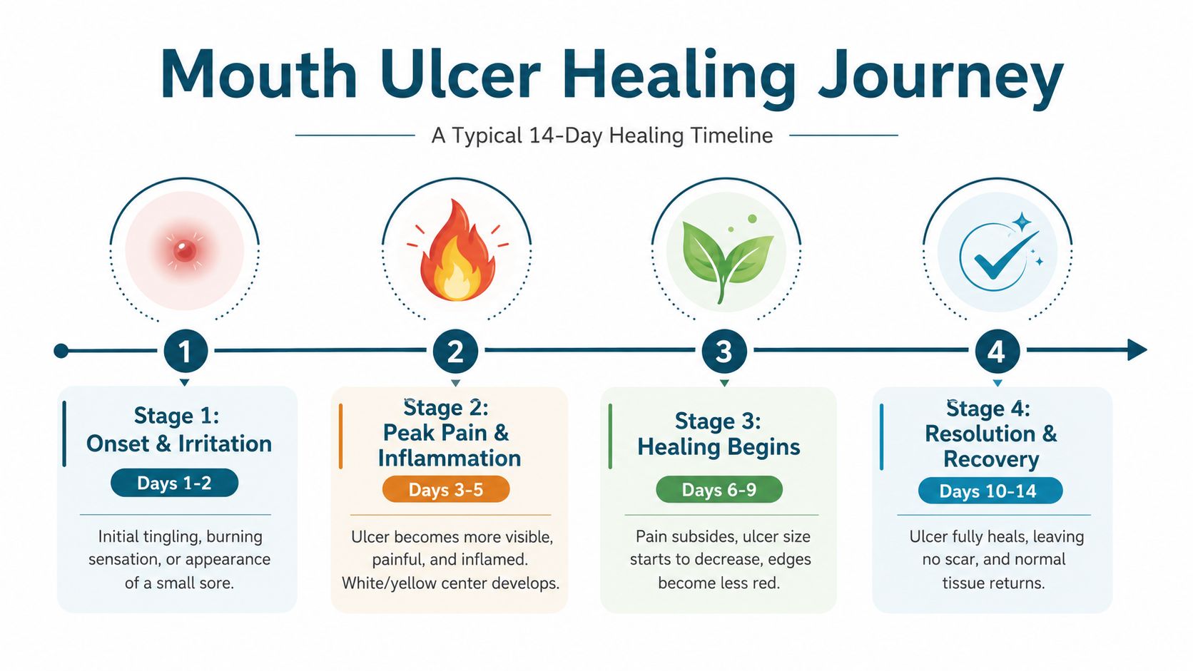 A four-stage infographic showing the typical fourteen-day healing timeline and progression of a mouth ulcer.