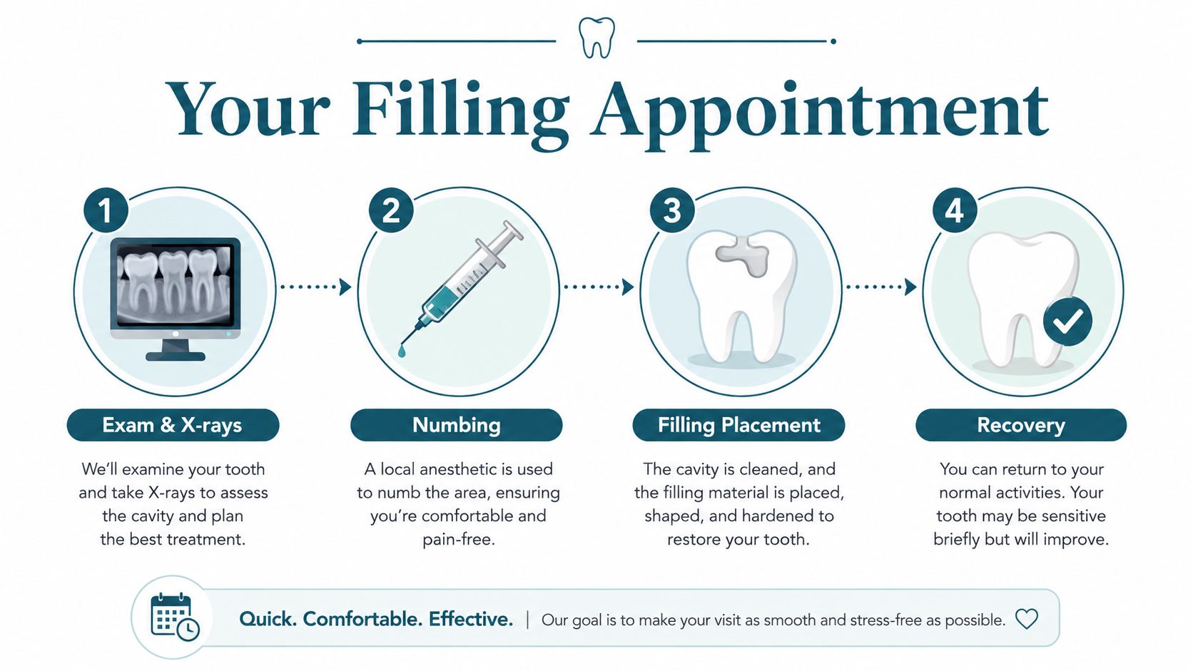 An infographic showing the four steps of a dental filling appointment from exam to recovery.
