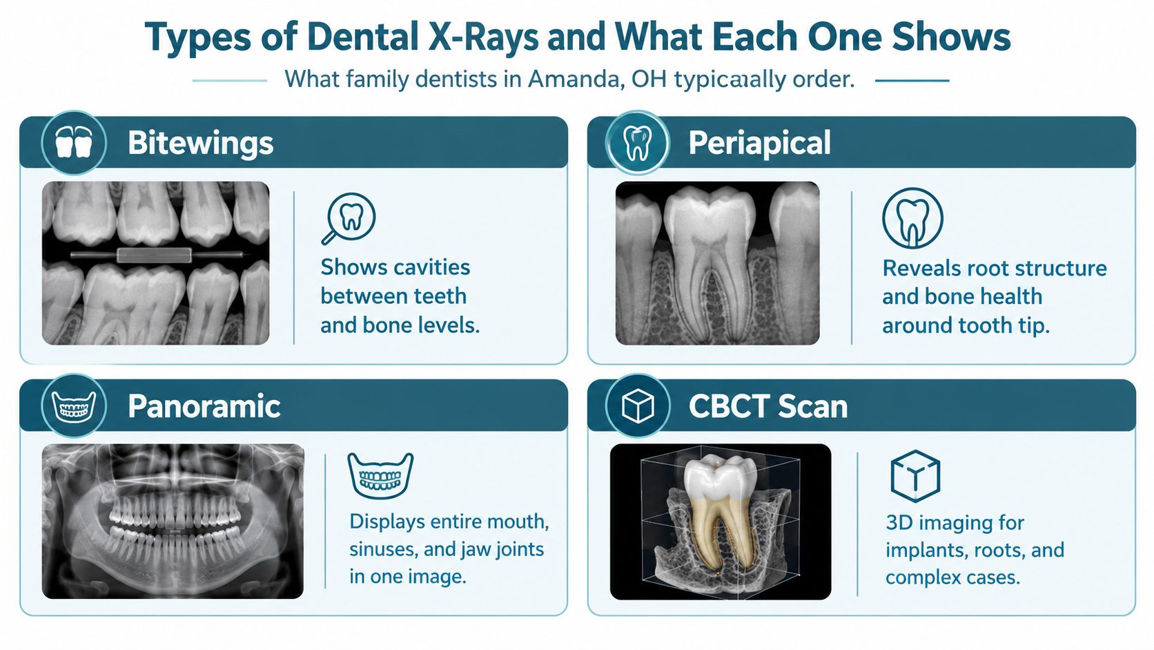A visual guide explaining different types of dental X-rays, including Bitewings, Periapical, Panoramic, and CBCT scans.