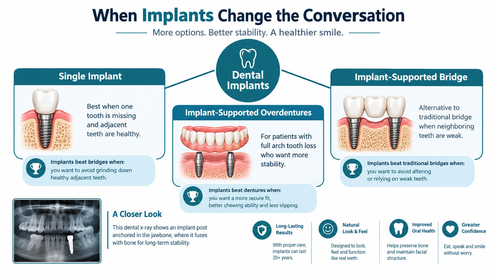 An infographic showing the benefits of dental implants compared to traditional bridges and dentures for tooth replacement.