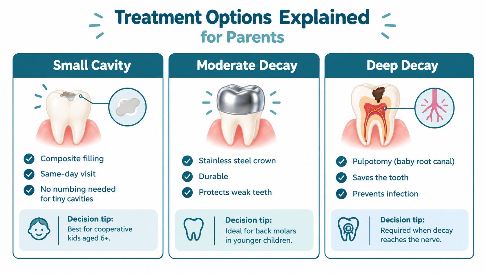 An infographic showing pediatric dental treatment options for small cavities, moderate decay, and deep decay in children.